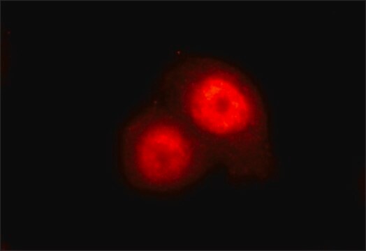 Anti-KLF5 antibody , Mouse monoclonal clone KLF5-55, purified from hybridoma cell culture