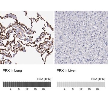 Anti-PRX antibody produced in rabbit Prestige Antibodies&#174; Powered by Atlas Antibodies, affinity isolated antibody, buffered aqueous glycerol solution