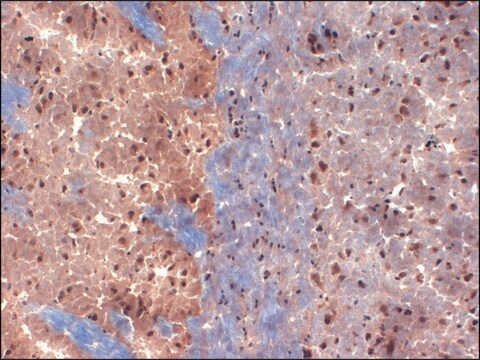 Monoclonal Anti-KCNA1 antibody produced in mouse clone S36-15, 1&#160;mg/mL, purified immunoglobulin