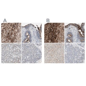 抗ALPL ウサギ宿主抗体 Ab1, Prestige Antibodies&#174; Powered by Atlas Antibodies, affinity isolated antibody, buffered aqueous glycerol solution