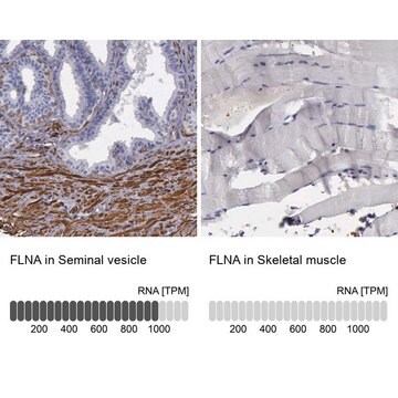 Anti-FLNA antibody produced in rabbit Ab2, Prestige Antibodies&#174; Powered by Atlas Antibodies, affinity isolated antibody, buffered aqueous glycerol solution