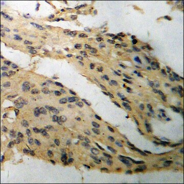 Anti-phospho-Tau (pSer396) antibody produced in rabbit affinity isolated antibody