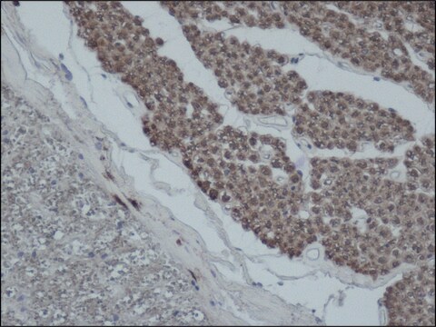 Anti-PMP22 antibody produced in rabbit ~1.0&#160;mg/mL, affinity isolated antibody, buffered aqueous solution