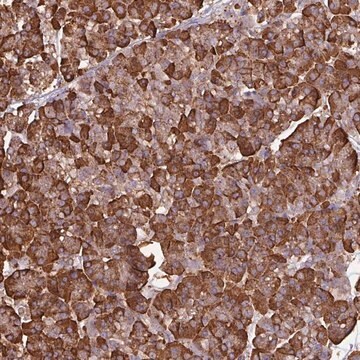 Anti-WBSCR22 antibody produced in rabbit Prestige Antibodies&#174; Powered by Atlas Antibodies, affinity isolated antibody, buffered aqueous glycerol solution