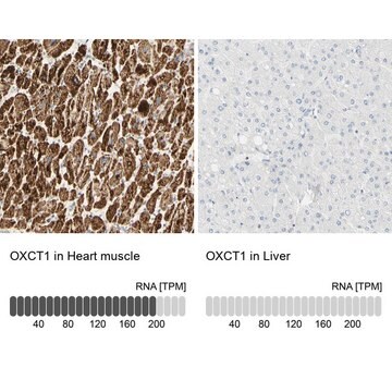 Anti-OXCT1 antibody produced in rabbit Prestige Antibodies&#174; Powered by Atlas Antibodies, affinity isolated antibody, buffered aqueous glycerol solution