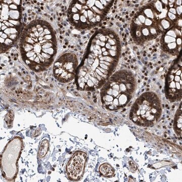 Anti-TRDMT1 antibody produced in rabbit Prestige Antibodies&#174; Powered by Atlas Antibodies, affinity isolated antibody, buffered aqueous glycerol solution