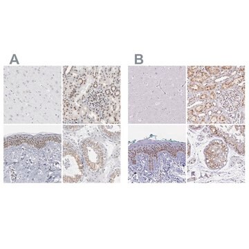 抗SYNE2 ウサギ宿主抗体 Prestige Antibodies&#174; Powered by Atlas Antibodies, affinity isolated antibody, buffered aqueous glycerol solution