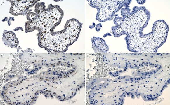 Anti-LATS1 Antibody, clone 1D18 ZooMAb&#174; Rabbit Monoclonal recombinant, expressed in HEK 293 cells