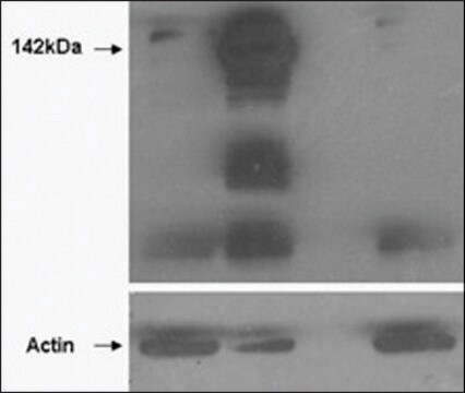 Anti-TNKS (N-terminal) antibody produced in goat affinity isolated antibody, buffered aqueous solution