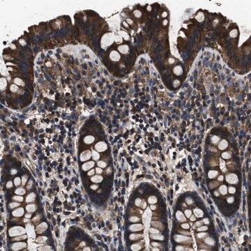 Anti-HSCB antibody produced in rabbit Prestige Antibodies&#174; Powered by Atlas Antibodies, affinity isolated antibody, buffered aqueous glycerol solution