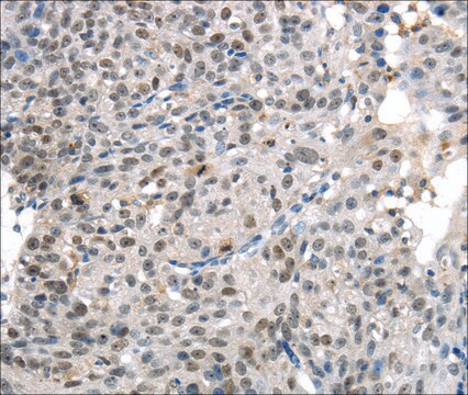 Anti-KDM5C affinity isolated antibody