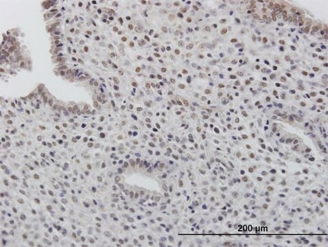 Anti-TOB1 antibody produced in mouse purified immunoglobulin, buffered aqueous solution