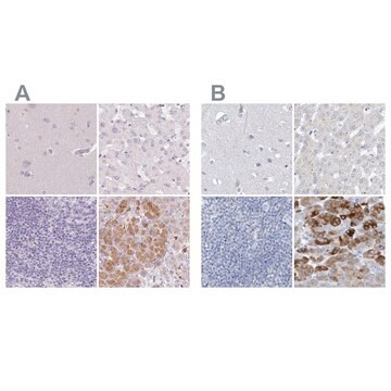 抗CTRL抗体 ウサギ宿主抗体 Prestige Antibodies&#174; Powered by Atlas Antibodies, affinity isolated antibody, buffered aqueous glycerol solution