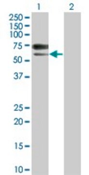 Monoclonal Anti-ACVRL1 antibody produced in mouse clone 7H2, purified immunoglobulin, buffered aqueous solution