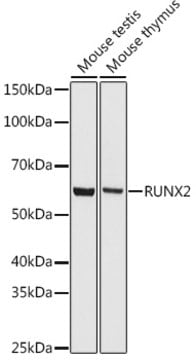 Anti-RUNX2 Antibody, clone 7O7J4, Rabbit Monoclonal