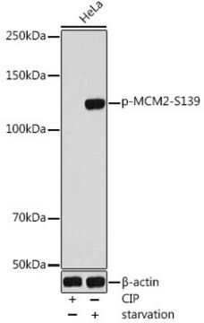 Anti-Phospho-MCM2-S139