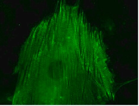 LentiBrite &#945;-actinin-GFP Lentiviral Biosensor