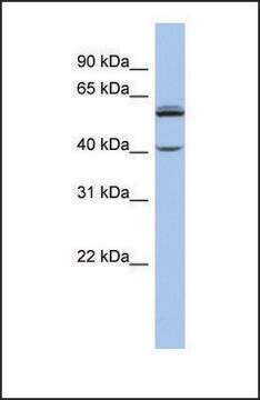 抗-CYP4V2 兔抗 affinity isolated antibody