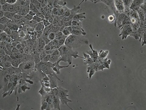 MOC22 Mouse Oral Squamous Cell Carcinoma (OSCC) Cell Line