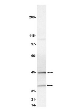 Anti-Caspase 9 Antibody, clone 96-2-22 clone 96-2-22, Upstate&#174;, from mouse