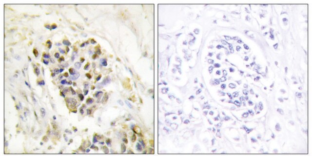 Anti-MED1 antibody produced in rabbit affinity isolated antibody