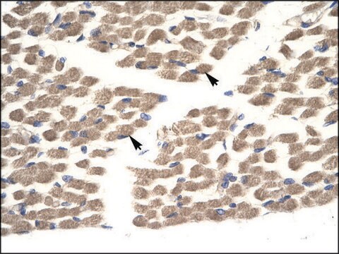 Anti-POU2F3 antibody produced in rabbit affinity isolated antibody