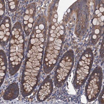 Anti-ADCY9 antibody produced in rabbit Prestige Antibodies&#174; Powered by Atlas Antibodies, affinity isolated antibody, buffered aqueous glycerol solution