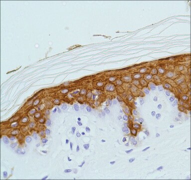 Anti-Keratin 10 antibody, Rabbit monoclonal clone SP99, recombinant, expressed in proprietary host, affinity isolated antibody