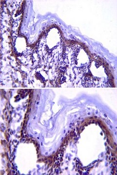 Anti-Fibrillin (Pan) Antibody, clone 689 clone 689, from mouse