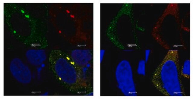 抗-YTHDF2抗体 from rabbit, purified by affinity chromatography