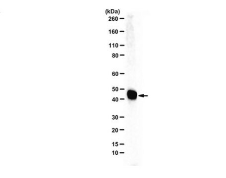 Anti-Ferrochelatase serum, from rabbit