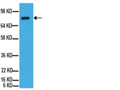 Anticorps anti-ADAM&nbsp;10 (extrémité C-terminale) Chemicon&#174;, from rabbit