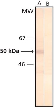 モノクロナール抗リン酸化セリン マウス宿主抗体 clone PSR-45, ascites fluid