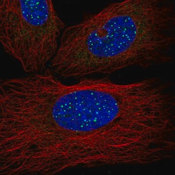 抗TINF2抗体 ウサギ宿主抗体 Prestige Antibodies&#174; Powered by Atlas Antibodies, affinity isolated antibody