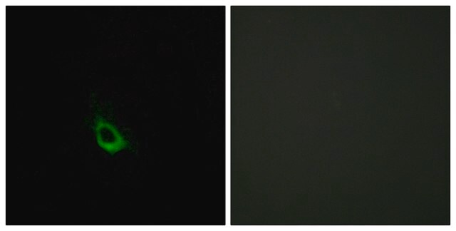 Anti-CARD10 antibody produced in rabbit affinity isolated antibody