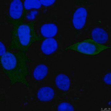 Anti-Luciferase-Antikörper from rabbit, purified by affinity chromatography