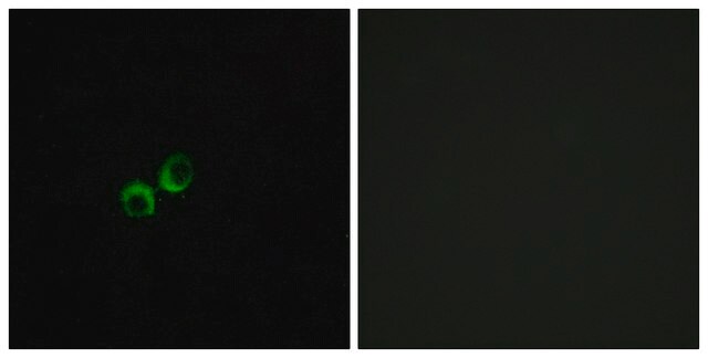 Anti-TAS1R3 antibody produced in rabbit affinity isolated antibody