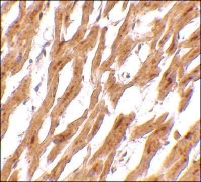 Anti-ASAH1 antibody produced in rabbit affinity isolated antibody, buffered aqueous solution