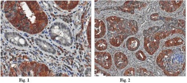 Anti-Atg18 (WIPI-2) Antibody, clone 2A2 clone 2A2, from mouse