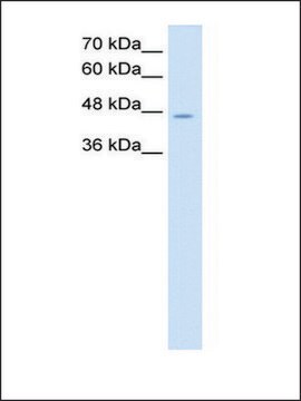 Anti-NDRG1 (AB1) antibody produced in rabbit IgG fraction of antiserum