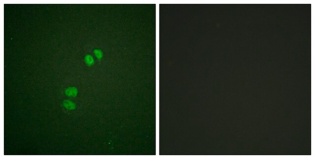 Anti-PLK1 antibody produced in rabbit affinity isolated antibody