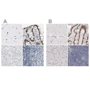 Anti-ZBTB7B antibody produced in rabbit Prestige Antibodies&#174; Powered by Atlas Antibodies, affinity isolated antibody, buffered aqueous glycerol solution, Ab1