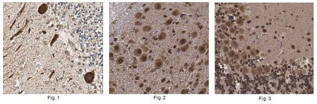 Anti-YY1AP1 Antibody from rabbit, purified by affinity chromatography