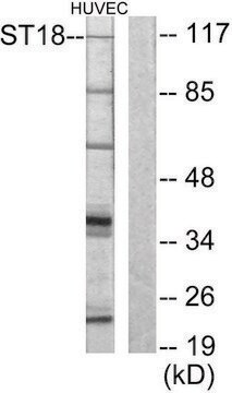 Anti-ZNF387 antibody produced in rabbit affinity isolated antibody