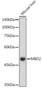 Anti-MBD2 Antibody, clone 4D4D5, Rabbit Monoclonal