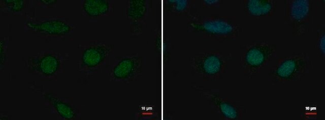 Anti-ERCC3 antibody produced in rabbit