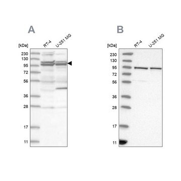 Anti-TBC1D5 antibody produced in rabbit Prestige Antibodies&#174; Powered by Atlas Antibodies, affinity isolated antibody, buffered aqueous glycerol solution