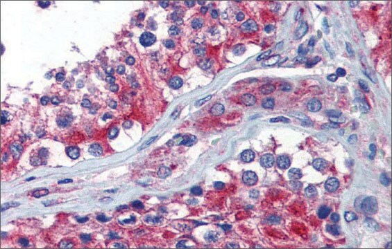 抗NPY1R抗体 ウサギ宿主抗体 affinity isolated antibody