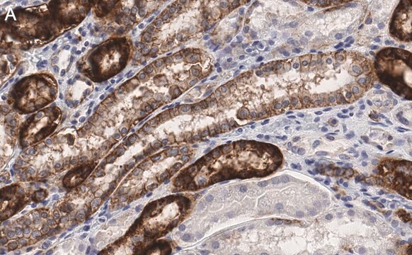 抗Na+/K+ ATPase &#945;-1 抗体 クローン C464.6 ZooMAb&#174; マウス・モノクローナル recombinant, expressed in HEK 293 cells