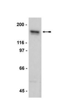 Anticuerpo anti-NR2A, clon A12W, monoclonal de conejo culture supernatant, clone A12W, Upstate&#174;